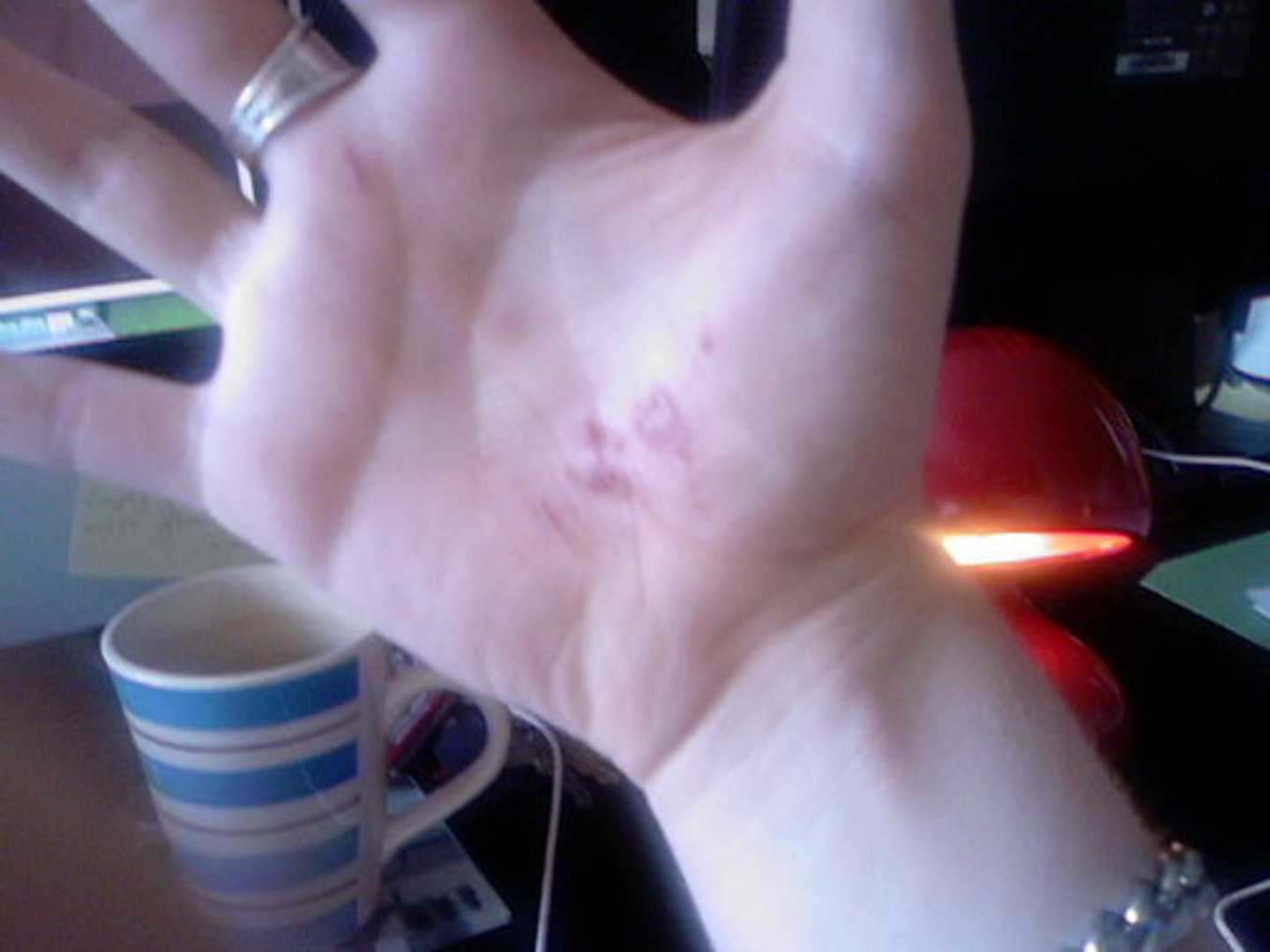 <p>to cure</p>