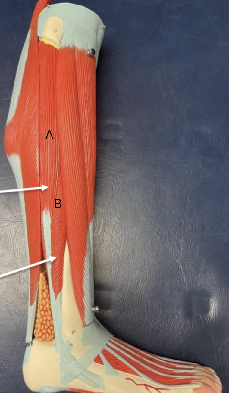<p>Label A and B muscles </p>