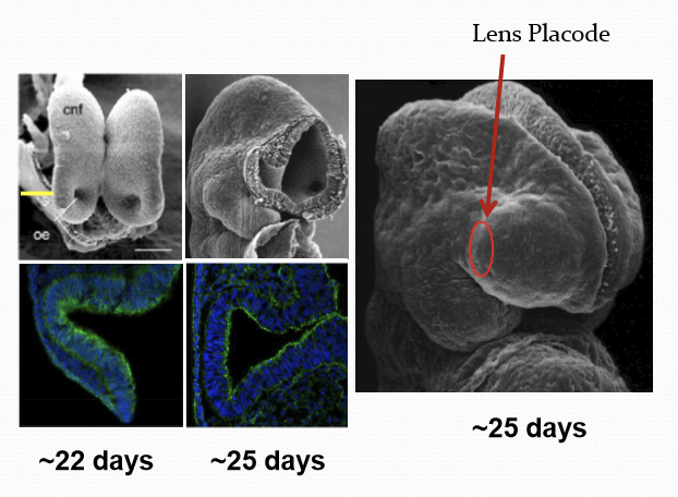 <p>The formation of the lens placode. </p>