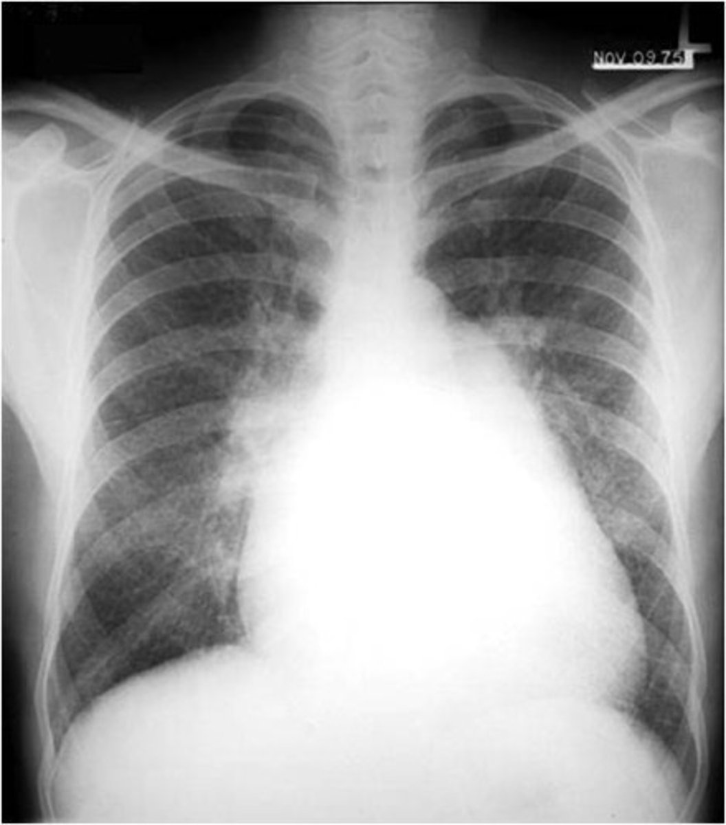 <p>What pathology is this?</p>