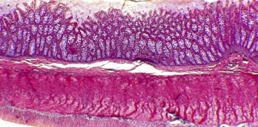 <p>What is the histology?</p>