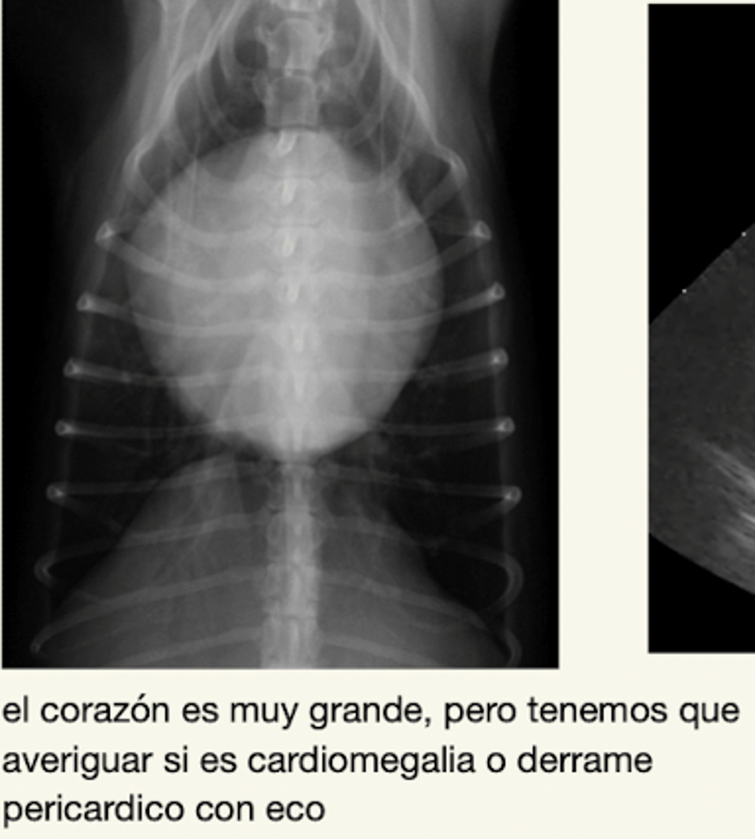 <p>un corazón muy grande y redondo.</p><p>parece el mismo que cardiomegalia- entonces es importante averiguar cual es con ecografía</p>