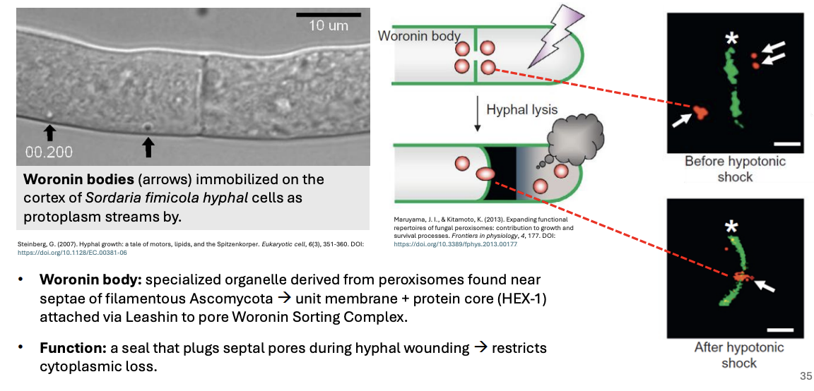 <p><strong>Unit membrane + Protein core (HEX-1)</strong> attached via <strong>Leashin</strong> to pore Woronin Sorting Complex</p>