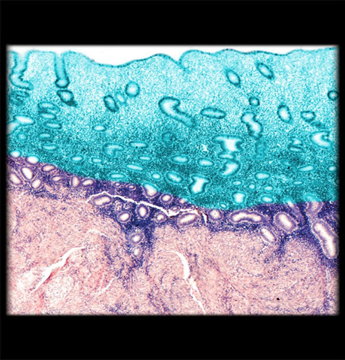 <p>in endometrium</p>