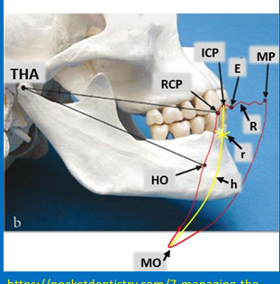 <p>mandibular border movements as it moves in the sagittal plane</p>
