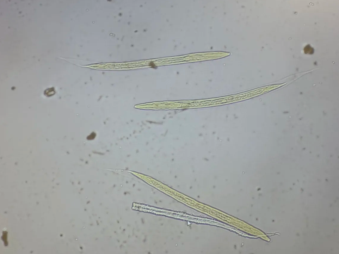 <p>larva found in Baermann funnel&nbsp;</p>