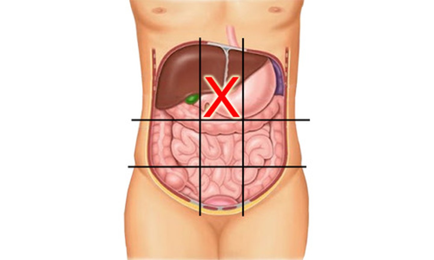 knowt flashcard image