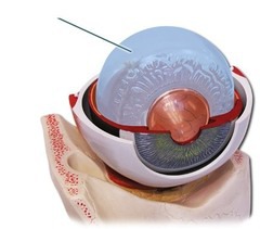 <p>The thick, clear jelly that helps give the eyeball its shape.</p>