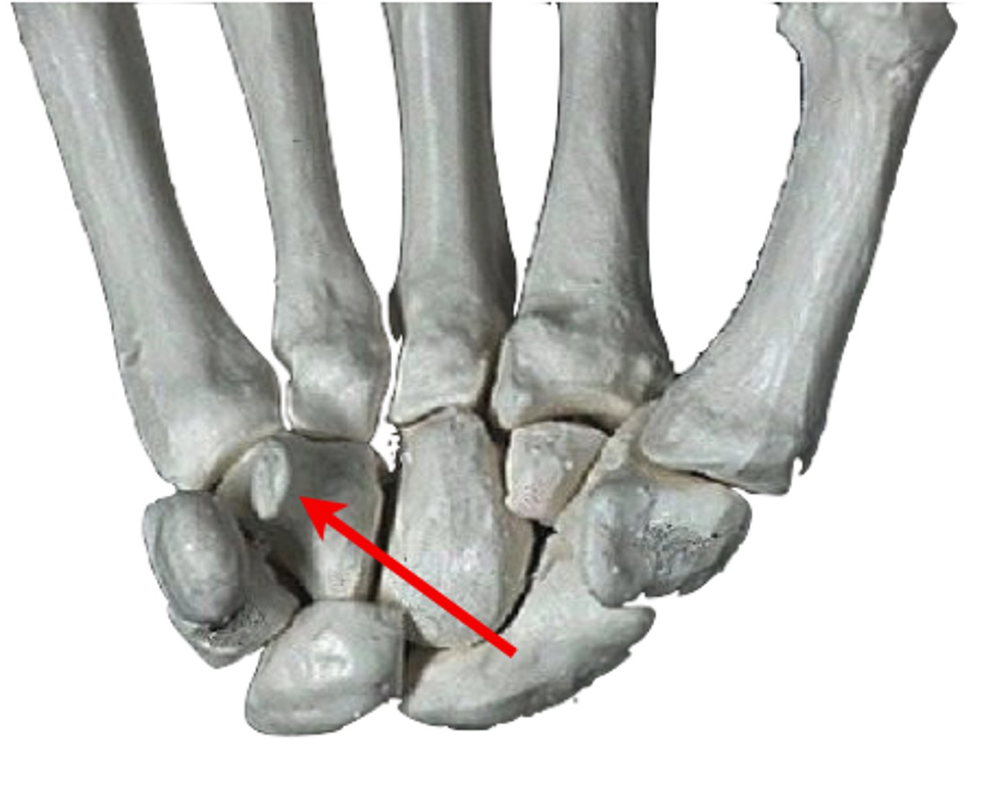 <p>Projection on the anterior surface of the hamate, providing attachment for the transverse carpal ligament.</p>