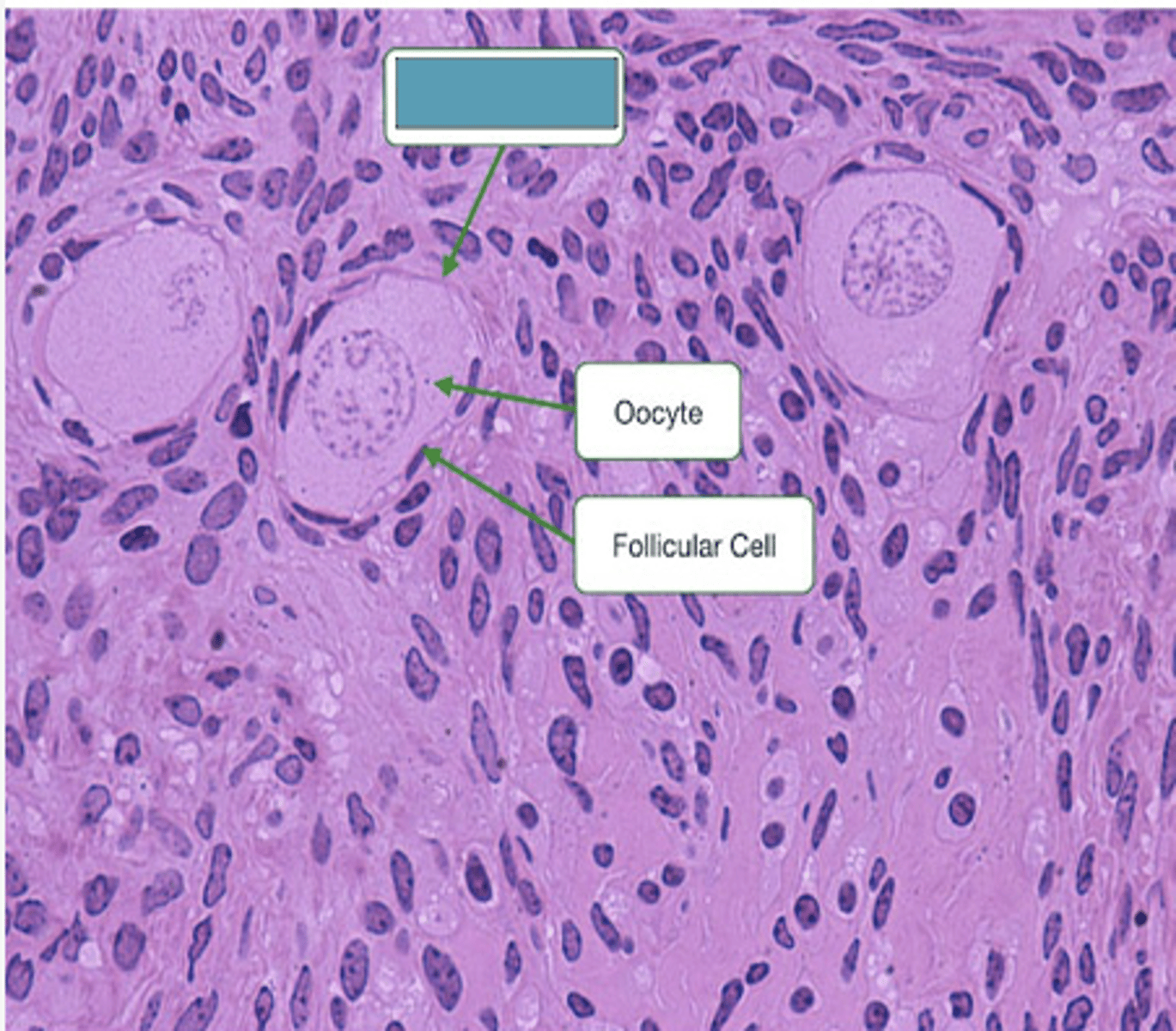 <p>Identify the stage of the follicle</p>