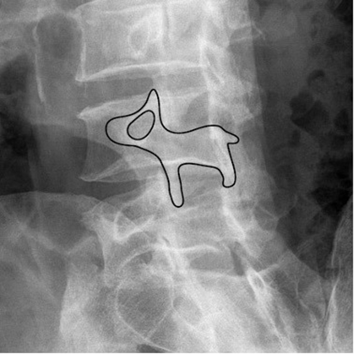 <p>nose- transverse process</p><p>eye- pedicle</p><p>ear- superior articular facet</p><p>front leg- inferior articular facet</p><p>neck- pars interarticularis</p>