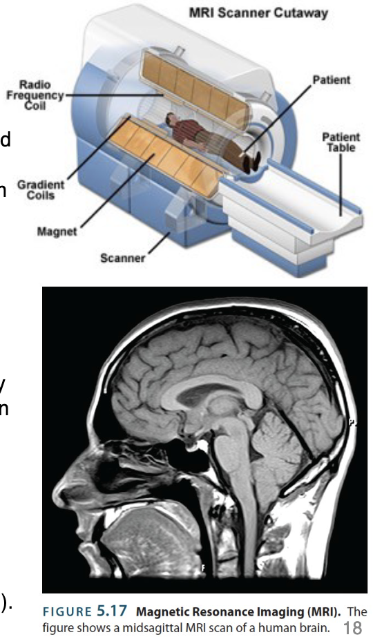 <p>fMRI → imaging technique that uses a rapid series of MRI scans measuring the movement of magnetic field distortions over time</p><ul><li><p>Same process as MRI, but with measuring blood oxygen levels in a locale</p></li><li><p>As magnetism is administered, blood oxygenation in a given area changes;</p></li><li><p>An area’s rapid ↑ in blood flow correlates positively with ↑ neural activity</p><p></p></li><li><p>fMRI scans have good spatial resolution and temporal resolution, providing great structural and functional information</p></li><li><p>Popular for being non-invasive</p></li></ul><p></p>