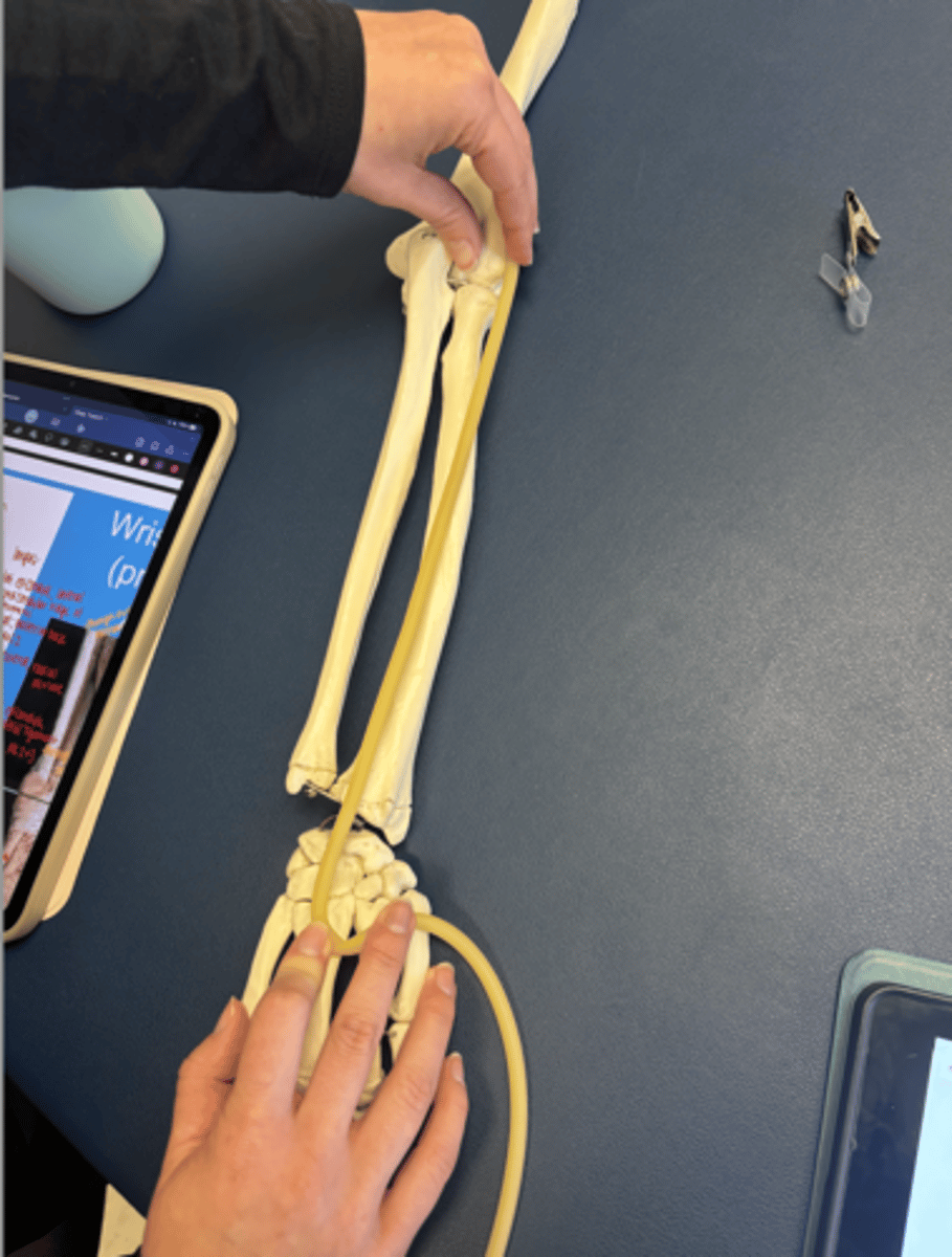 <p>What is this muscle?</p>