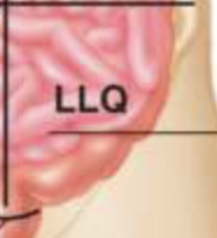 <p>What does the left lower abdominal quadrant contain?</p>