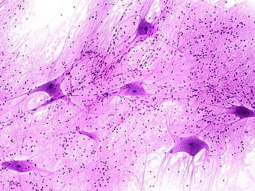 <p>Name the tissue</p>