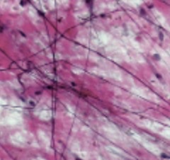 <p>deep layers of skin & white of eye</p>