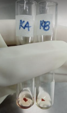<ul><li><p><strong>Blood Group: </strong>O</p></li></ul><ul><li><p><strong>Antibody/Antibodies Present: </strong>Anti-A, Anti-B, and Anti-AB</p></li><li><p><strong>Antigen(s) Present: </strong>None</p></li></ul><p></p><ul><li><p><strong>Known A1: </strong>4+</p></li><li><p><strong>Known B: </strong>4+</p></li></ul><p></p>