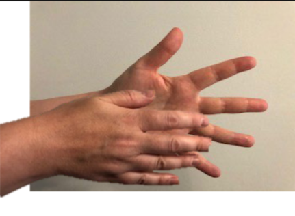 <p>Identify the Cranial Strain Pattern:</p>