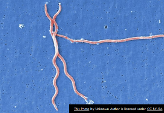 <p>They are spirochetes with internal flagella that allow corkscrew-like movement through the barrier.</p>