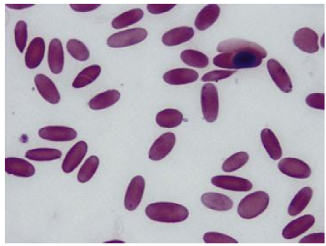 <ul><li><p>Bacteria of the family Rickettsiae</p></li><li><p><strong>unique to SACs </strong></p></li><li><p>transmitted by ticks </p></li><li><p>intracellular causing <strong>extravascular hemolysis </strong></p></li></ul><p>Clinical signs: </p><ul><li><p>fever, anemia, depression, icterus, infetility, edema, poor growth </p></li></ul><p>Diagnosis: </p><ul><li><p><strong>Blood smear, PCR, </strong>ELISA </p></li></ul><p>treatment: </p><ul><li><p>oxytetracycline injections </p></li><li><p>blood transfusion if PCV is less than 15% </p></li></ul><p></p>