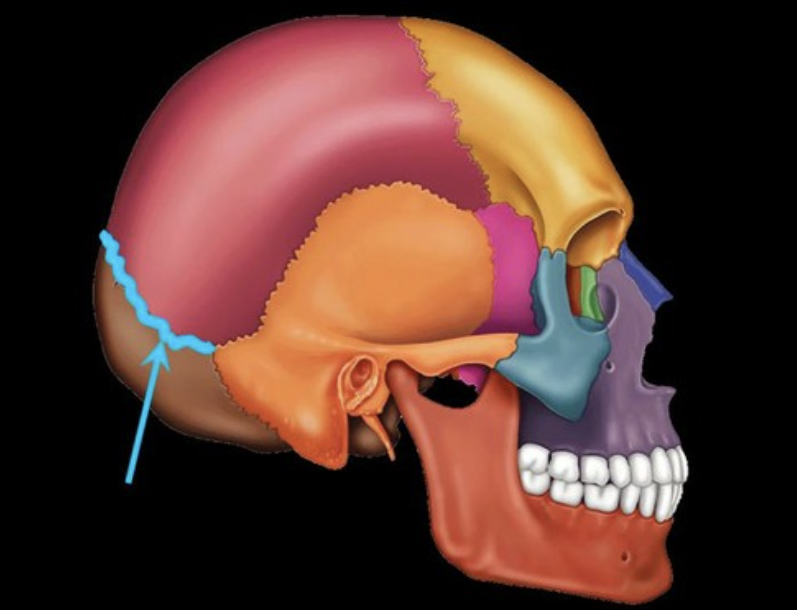term image