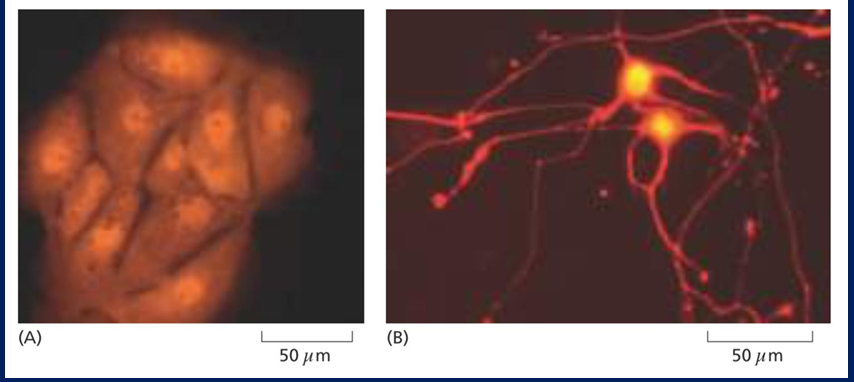 <p>An example is converting human fibroblasts into neurons by introducing a specific combination of transcription factors essential for neuronal identity.</p>