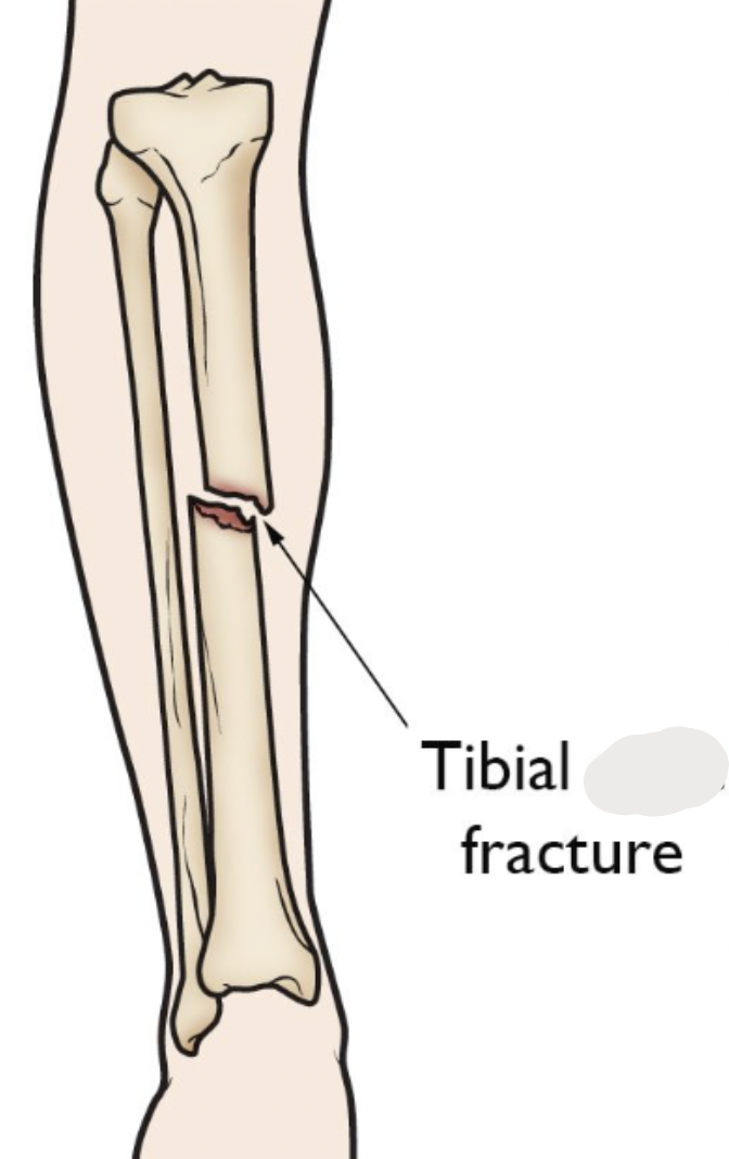 <p>proximal end of tibia:</p>