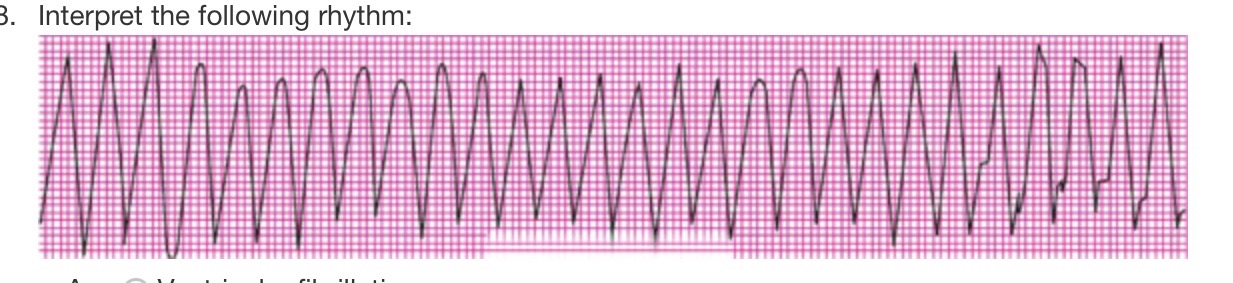 <p>interpret the rhythm </p>