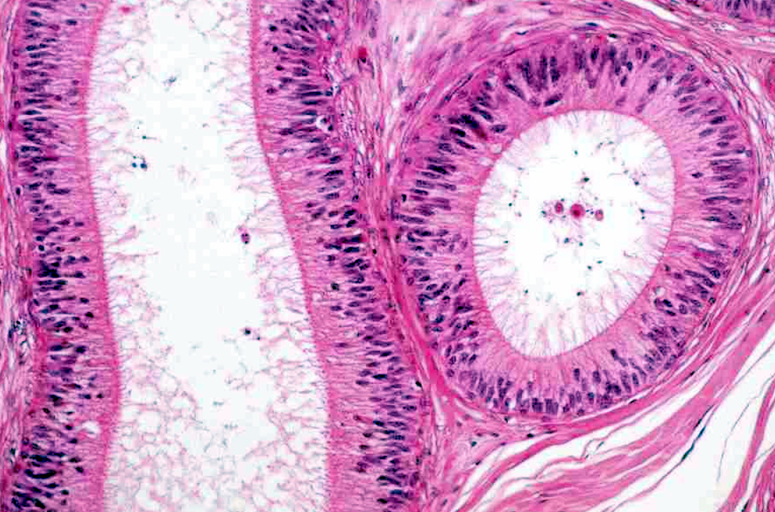 <p><span style="font-size: large">Observe the histological pattern of this specimen and select the correct identification from the list.</span></p><p><span style="font-size: large">a) epididymis</span></p><p><span style="font-size: large">b) ovary</span></p><p><span style="font-size: large">c) prostate gland</span></p><p><span style="font-size: large">d) testis</span></p><p><span style="font-size: large">e) uterus</span></p>