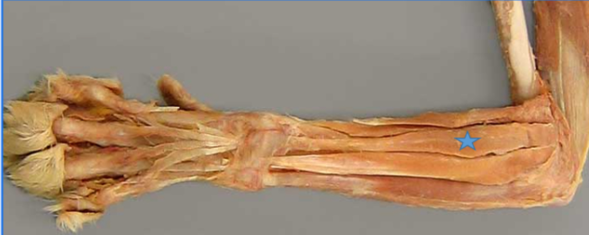 <p>Common digital extensor m. (blue star)</p>