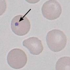 <ul><li><p>basophilic nuclear remnants in young RBC</p><ul><li><p>response to anemia</p></li></ul></li><li><p>removed via phagocytosis when passing through spleen</p></li><li><p>can be seen after removal of spleen </p></li></ul><p></p>