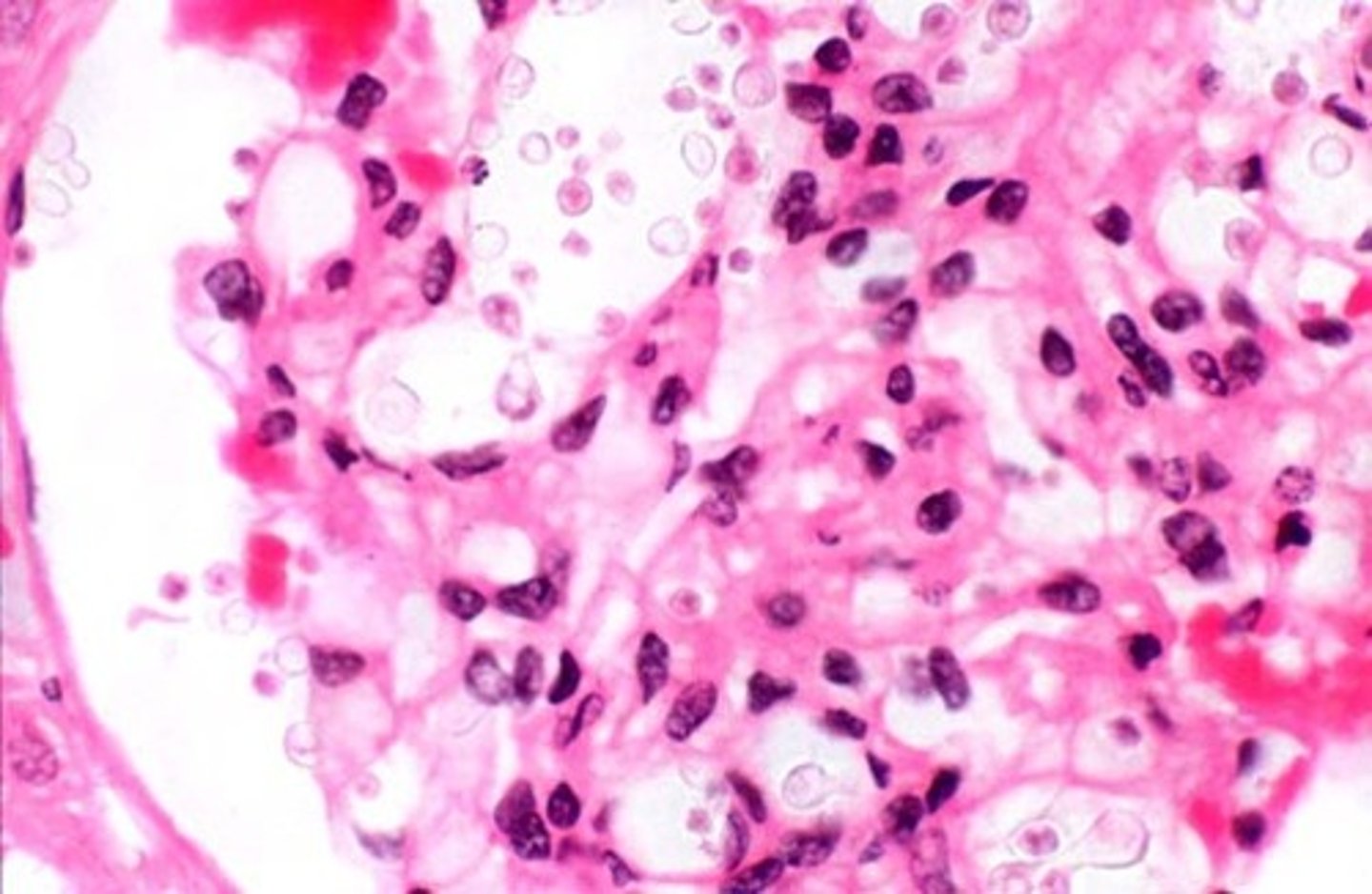 <p>Hematoxylin</p><p>- stains DNA and other acidic structures dark blue or purple Eosin</p><p>- stains other cytoplasmic components and collagen pink</p>