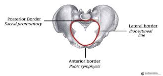 <p>Line separating true and false pelvis; includes pubic crest, pectineal line, and arcuate line.</p>