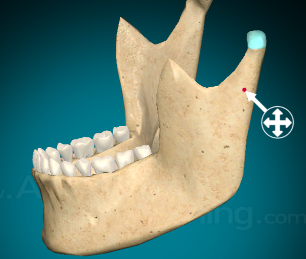 <p>Mandibular condyle</p>