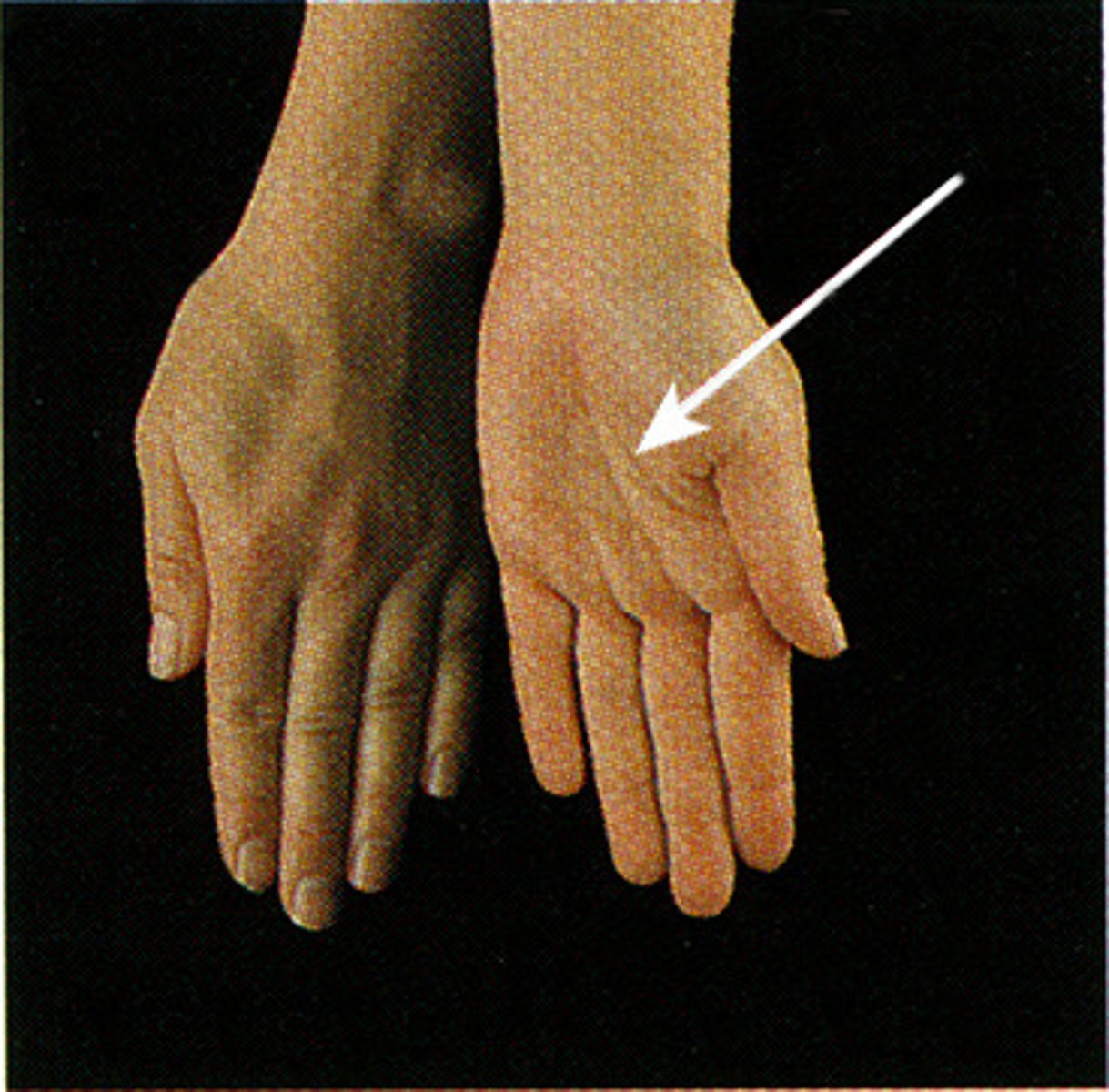 <p>Rotate lower arm and palm outward (like you're cupping soup)</p>