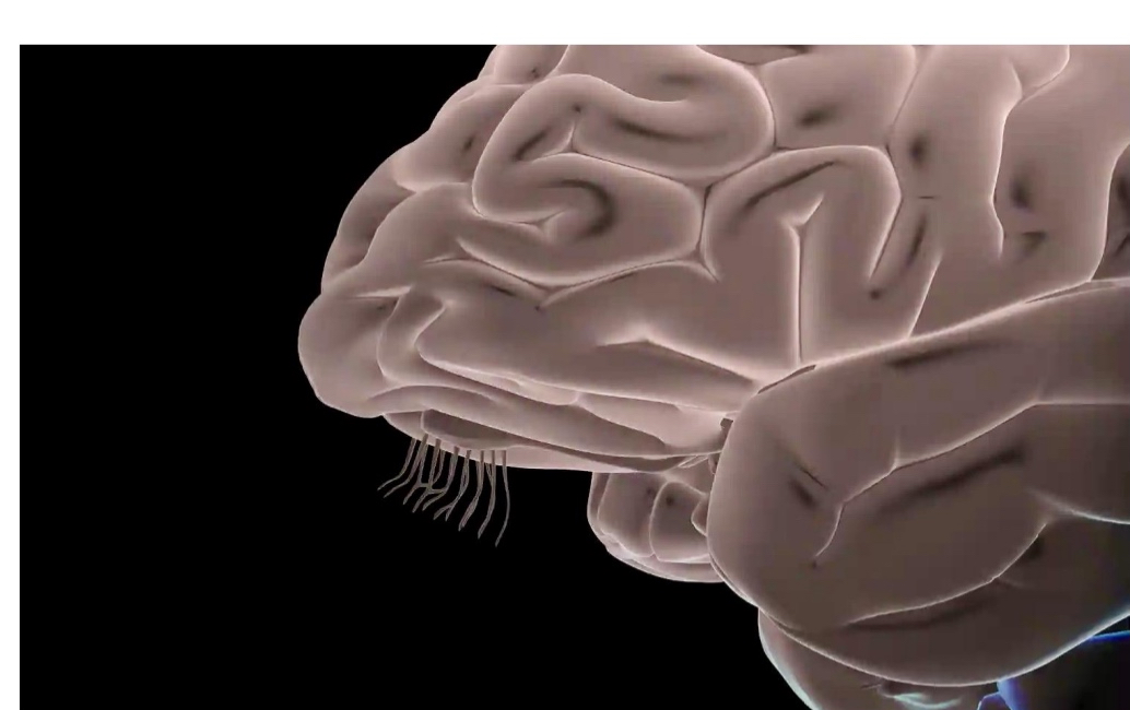 <ul><li><p>cranial nerve I; thin axons, slow</p></li><li><p>All the hairs on the toothbrush collectively</p></li><li><p>Cilia stimulated by odorants (not mechanical shearing forces) making olfactory system a chemical sense</p></li></ul><p></p>