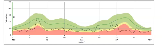 <p>effect of blood vessels </p>