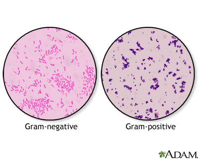<p> Different kinds of cells are different colors.</p><p>• Gram-positive bacteria appear purple-violet</p><p>•  Gram-negative bacteria appear pink</p><p><span><mark data-color="unset" style="background-color: unset; color: inherit;">Gram-positive bacteria have a thick peptidoglycan cell wall, retain the crystal violet stain, and appear purple.</mark> <mark data-color="unset" style="background-color: unset; color: inherit;">In contrast, gram-negative bacteria have a thin peptidoglycan layer and an outer membrane, lose the crystal violet stain, and appear pink</mark></span></p>