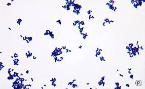 <p>How would you report this stain?</p>
