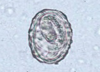 <p>what species produces this egg, and is it fertilized or unfertilized?</p>