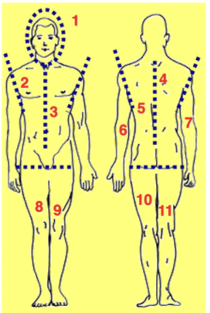 <p>each of the following accounts for 9% of total skin SA:</p><p>- all of head and neck</p><p>- right anterior trunk</p><p>- left anterior trunk</p><p>- right posterior trunk</p><p>- left posterior trunk</p><p>- right arm</p><p>- left arm</p><p>- right anterior leg</p><p>- left anterior leg</p><p>- right posterior leg</p><p>- left posterior leg</p><p>- groin = 1% SA</p>