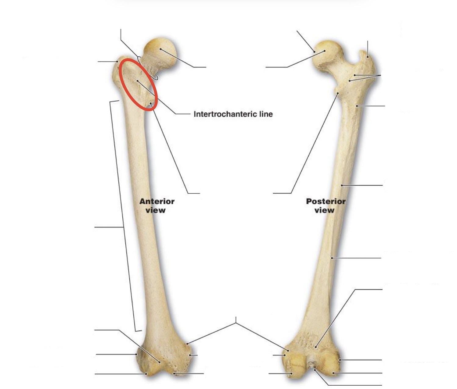 <p><span><span>Intertrochanteric line</span></span></p>