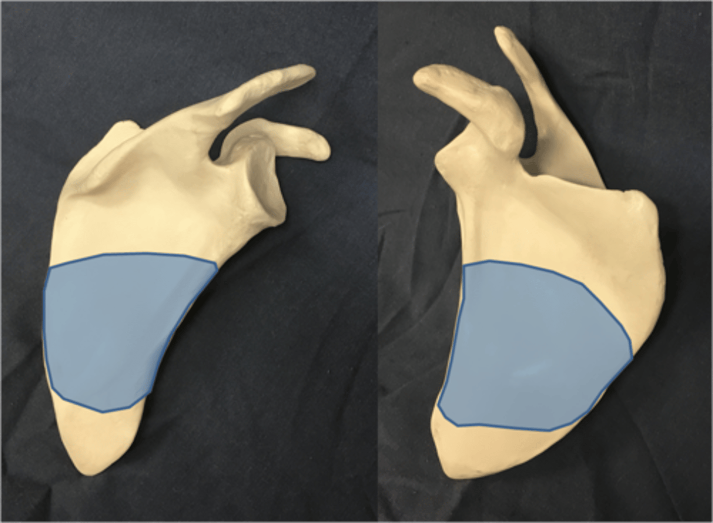 <p>Main portion of scapula. (Blade)</p>