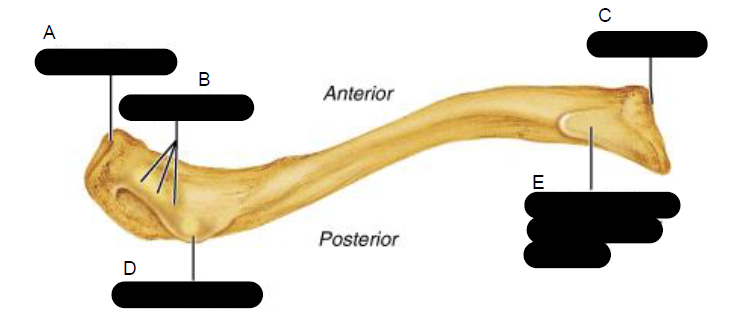 <p>Right clavicle, inferior view</p>
