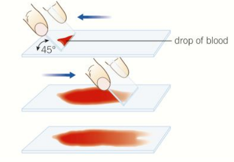 <ul><li><p>edge of slide is used to smear the sample creating a thin even coating on another slide</p></li><li><p>then place cover slip on</p></li><li><p>for example is blood</p></li></ul><p></p>