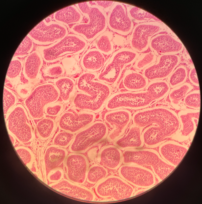• The male gonad.

• Composed of seminiferous tubules and interstitial cells.