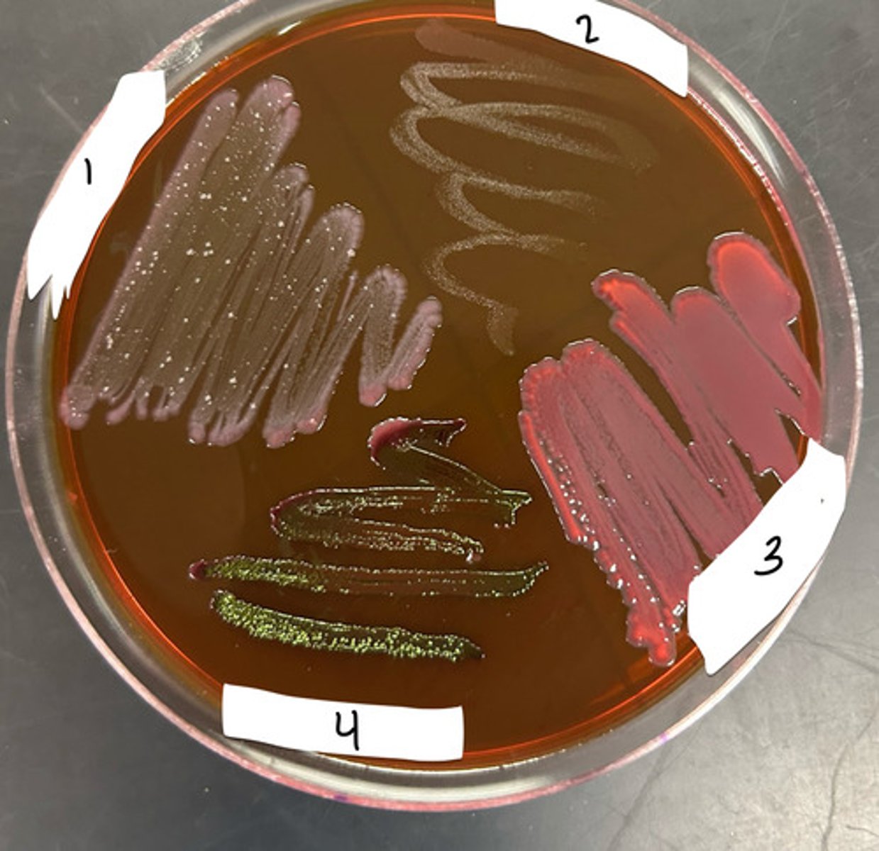 <p>state which microbe is in each section based on the reaction</p>