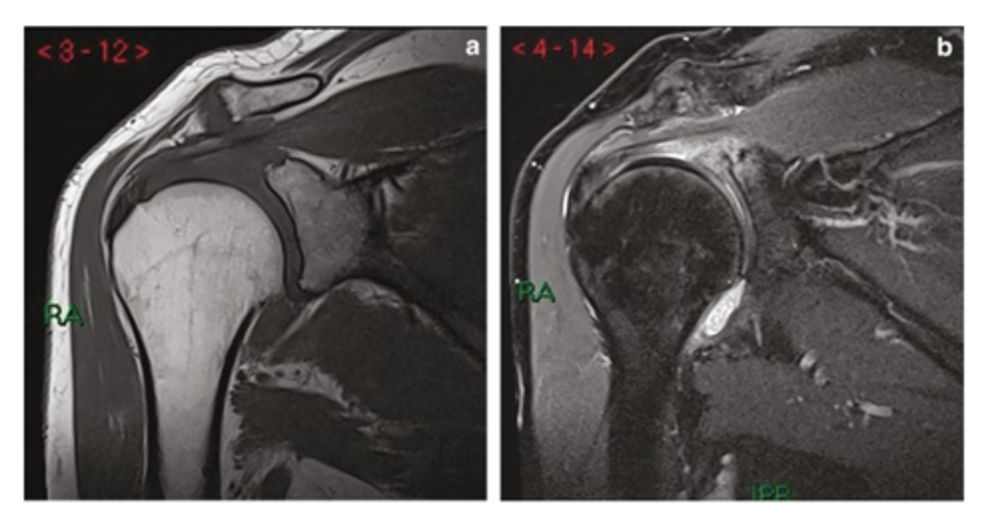 <p>What is this image depicting at the ACJ?</p>