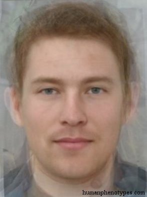 <p>Identify this Phenotype</p>
