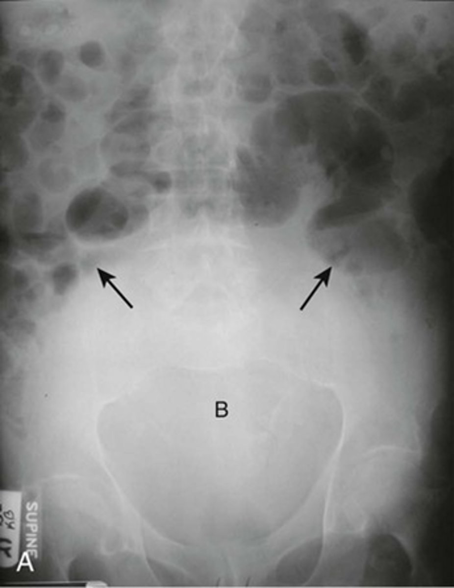 knowt flashcard image